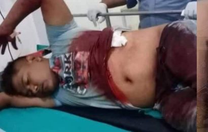 रूपन्देहीमा लुटेरा समूहले गाेलीहानी  युवक घाइते